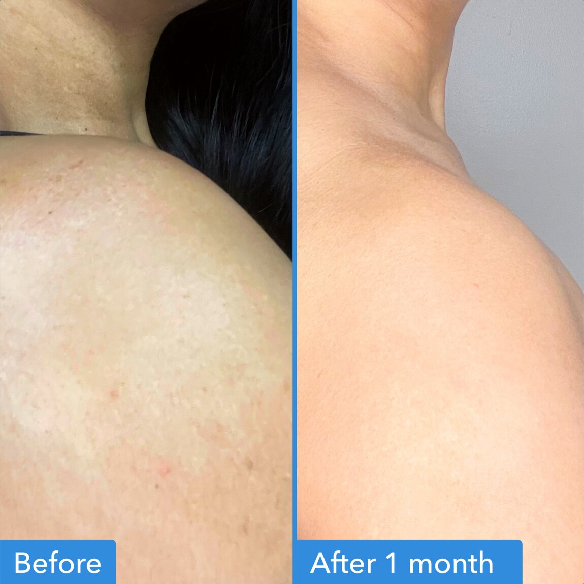 discoloration-correcting-body-treatment-x6 zb_p.jpg