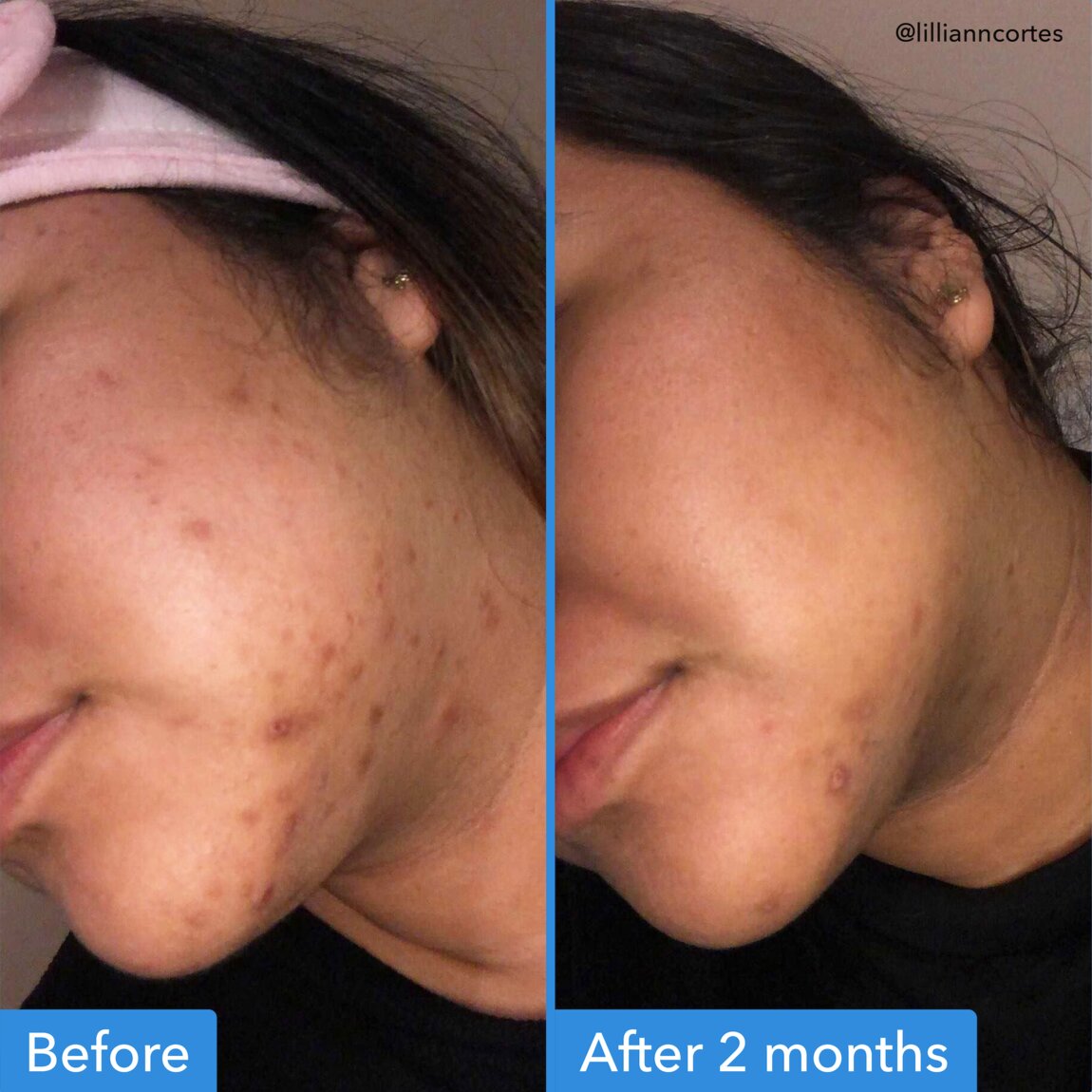 discoloration-correcting-serum-c8 zb_p.jpg