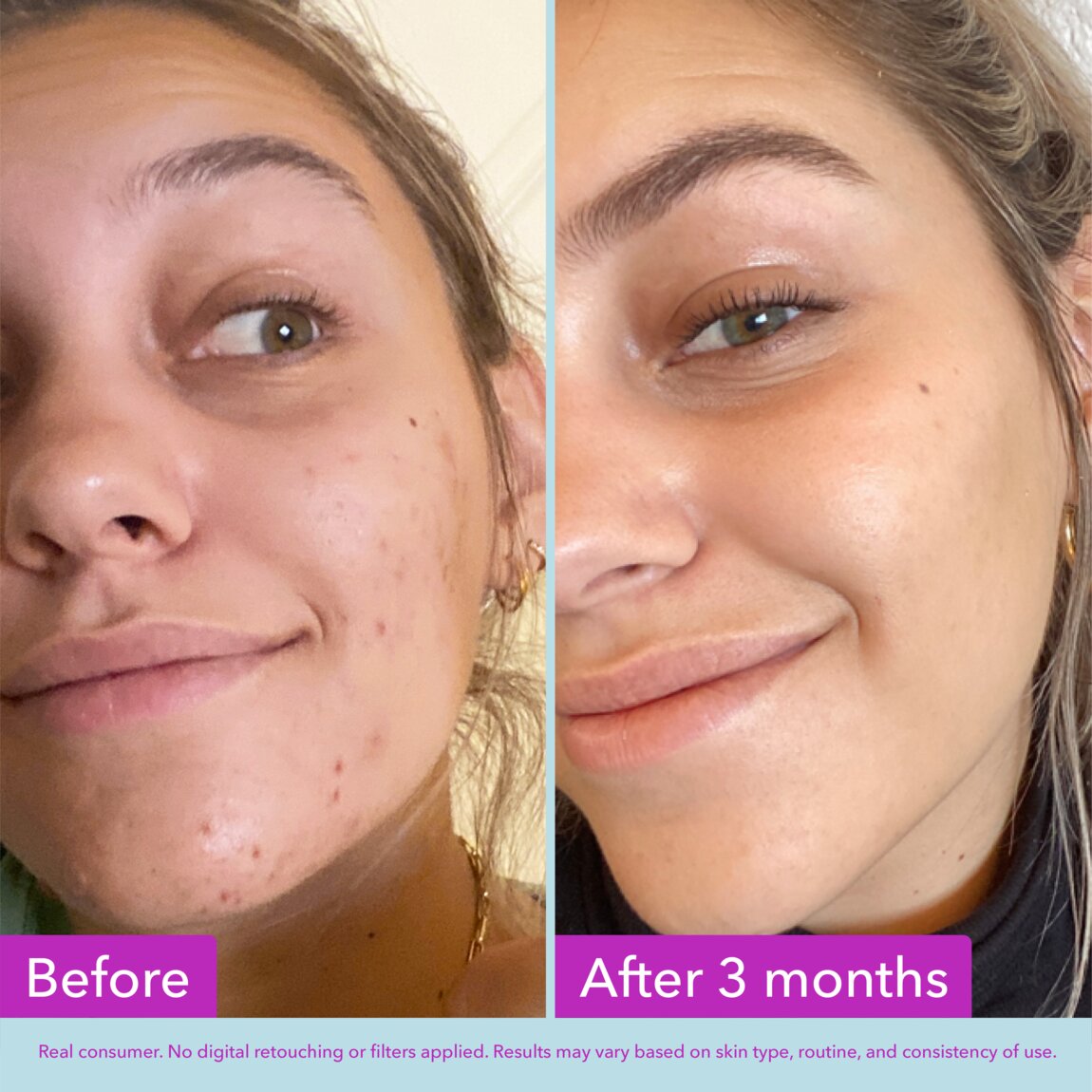 niacinamide-brightening-toner-i9 zb_p.jpg